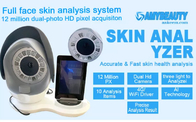 1200만 화소 휴대용 피부 분석 피부 미용 분석기 32G