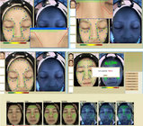 3d 피부병학 얼굴 피부 분석 기계 얼굴 스캐너 피부 분석기 40W